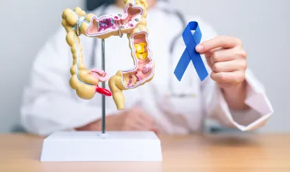 Câncer colorretal pode ser mais agressivo em jovens, diz estudo Trabalho realizado por pesquisadores brasileiros mostrou que adultos jovens apresentaram uma proporção maior de tumor agressivo em comparação aos pacientes mais velhos